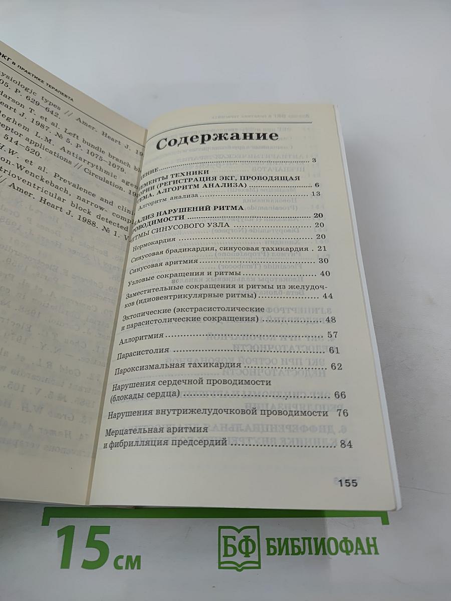 Анализ ЭКГ в практике терапевта