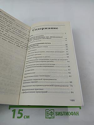 Анализ ЭКГ в практике терапевта