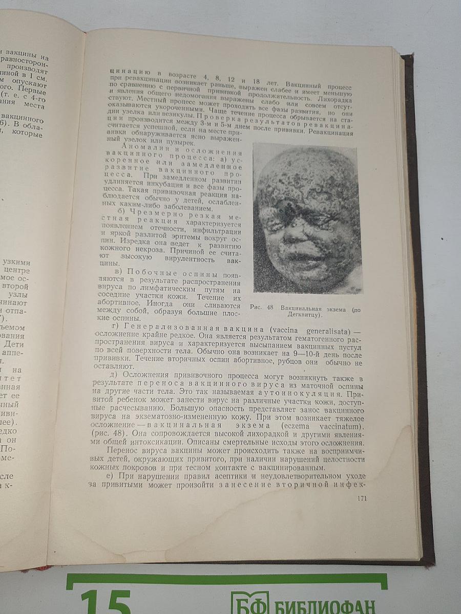 Учебник детских инфекционных болезней