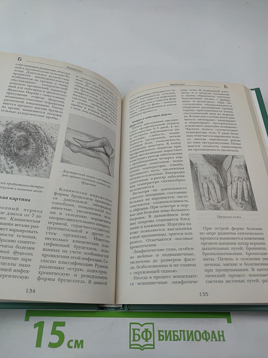 Большая медицинская энциклопедия. Том 2. АСЦ – ВНУ