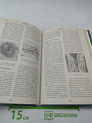 Большая медицинская энциклопедия. Том 2. АСЦ – ВНУ