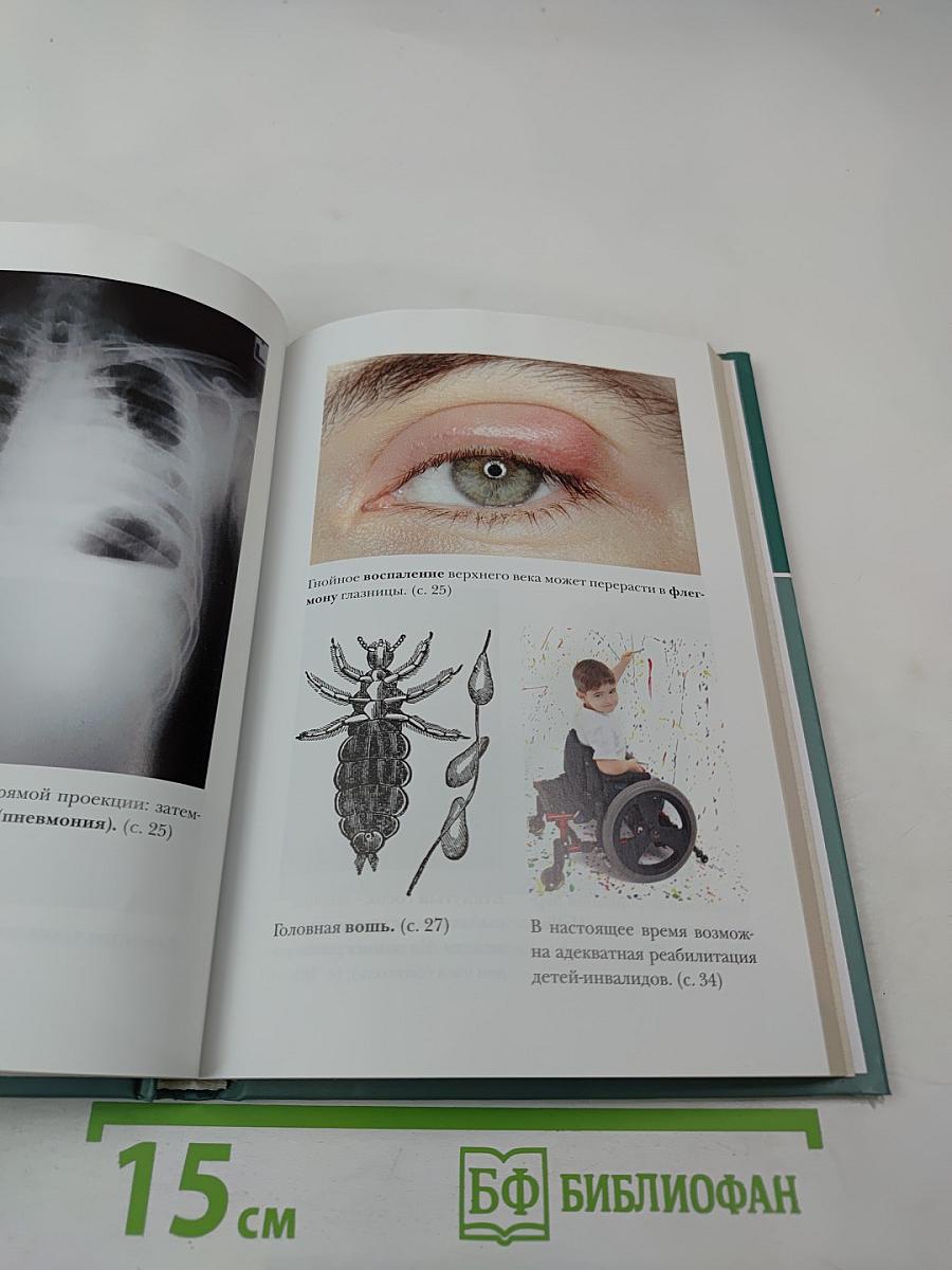 Большая медицинская энциклопедия. Том 3. Вну-Гид