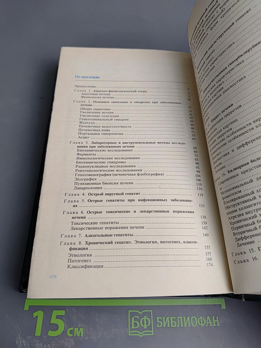 Болезни печени