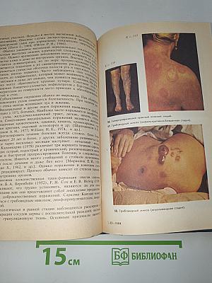Дифференциальная диагностика кожных болезней