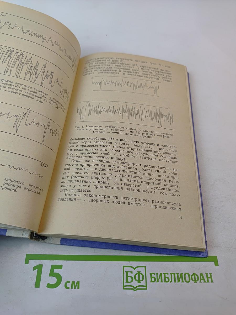 Очерки желудочной патологии