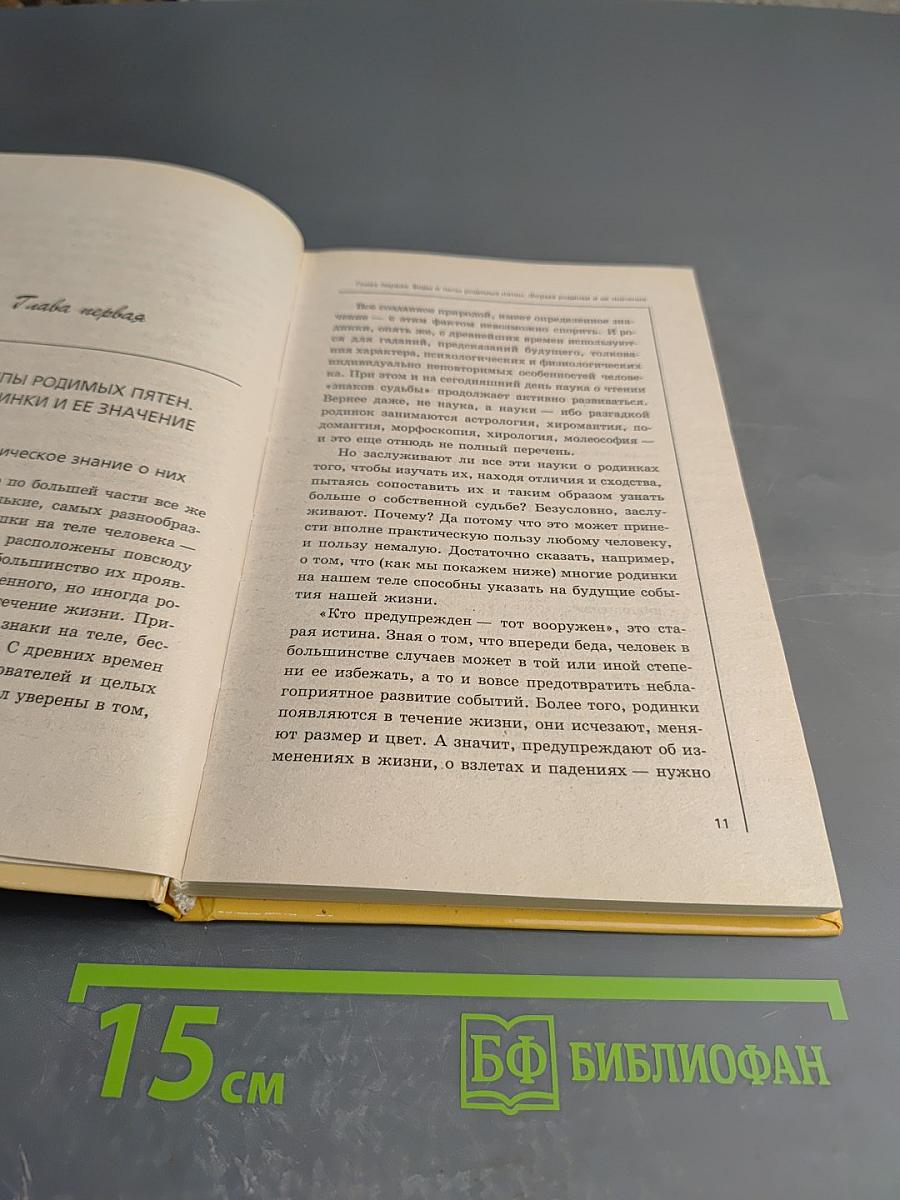 О чем говорят ваши родинки?