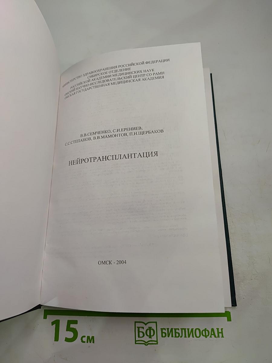 Нейротрансплантация