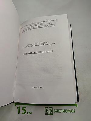 Нейротрансплантация