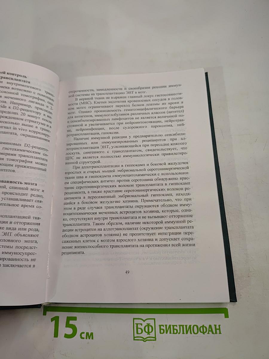 Нейротрансплантация