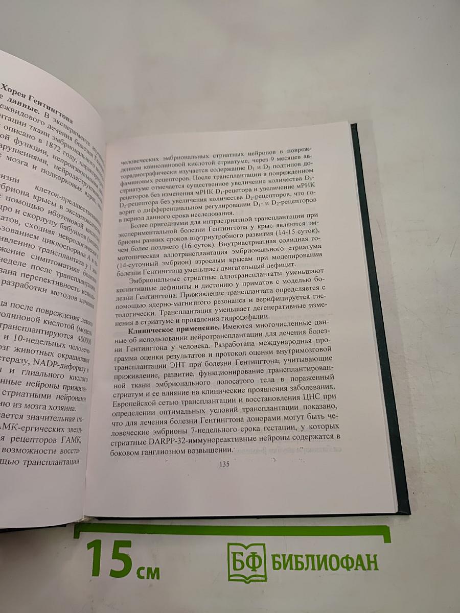 Нейротрансплантация