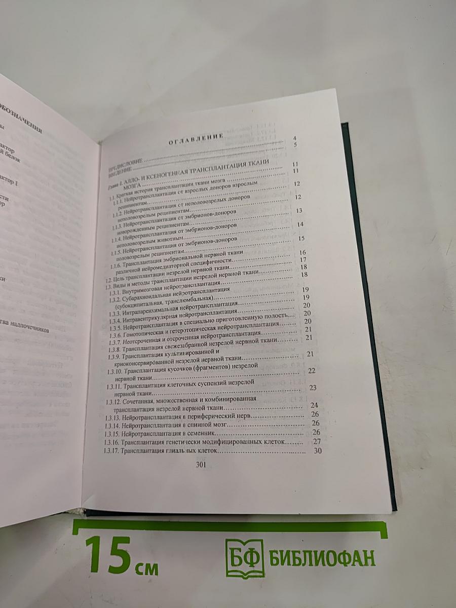 Нейротрансплантация