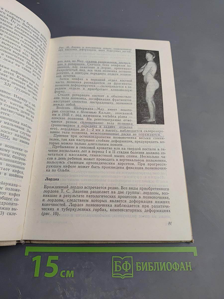 Детская ортопедия