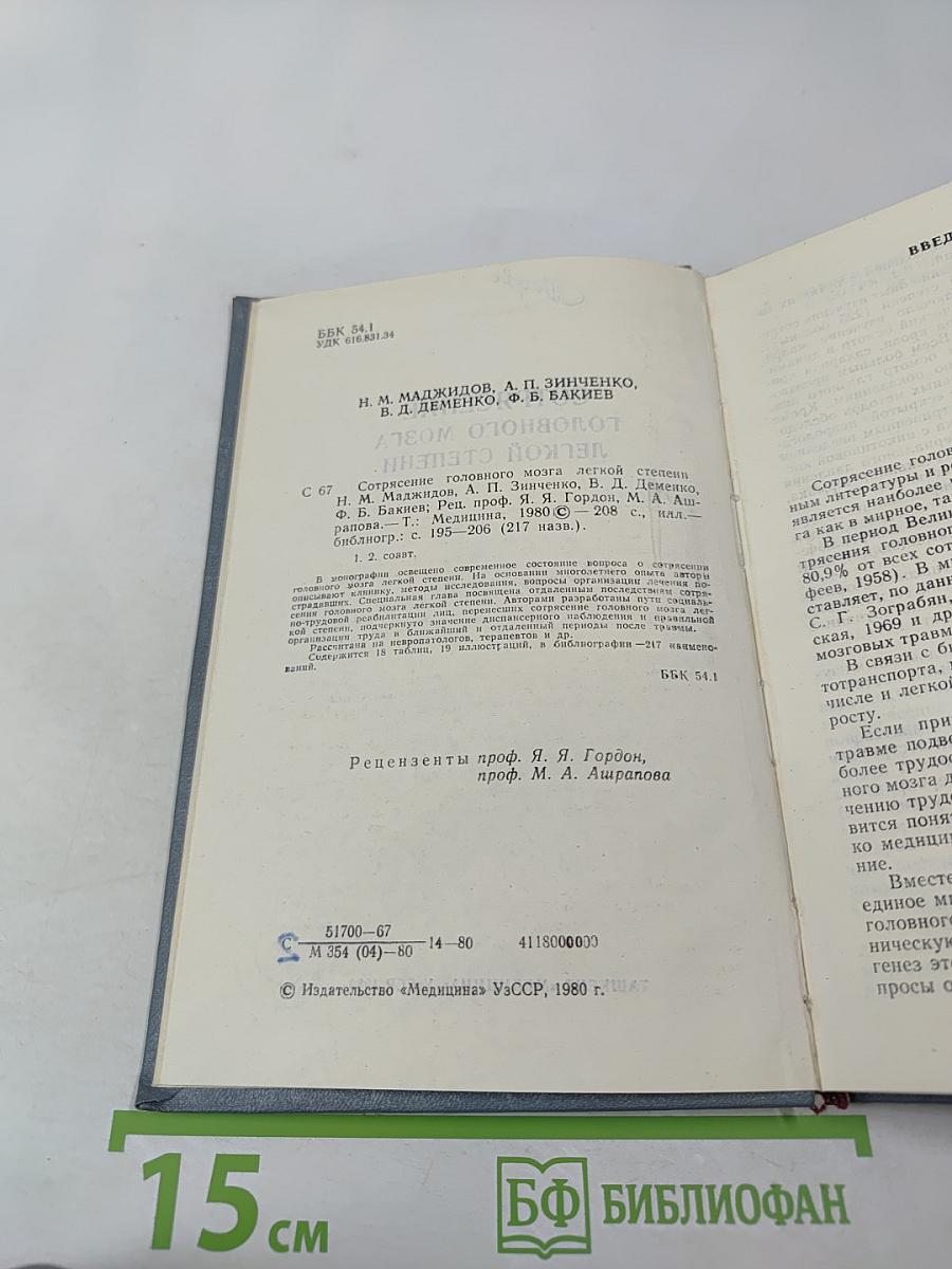 Сотрясение головного мозга легкой степени