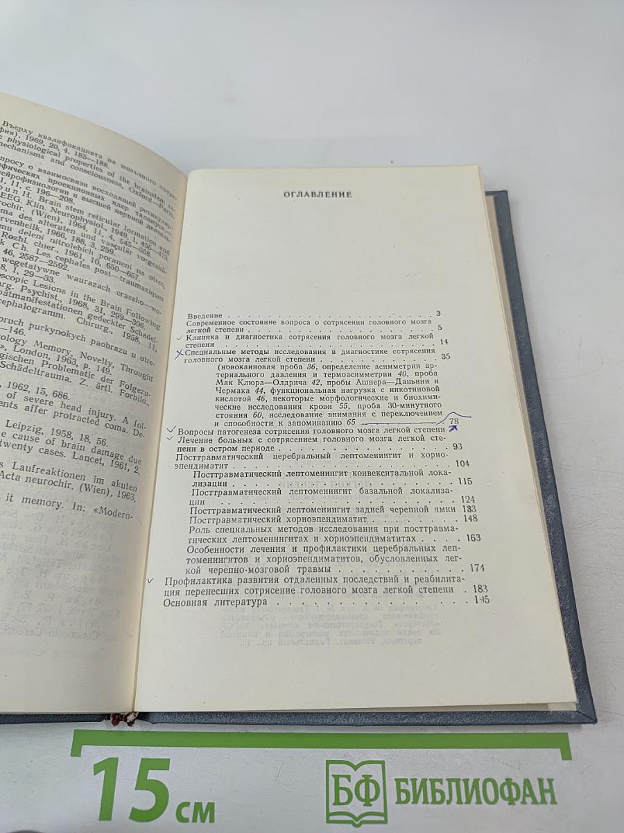 Сотрясение головного мозга легкой степени