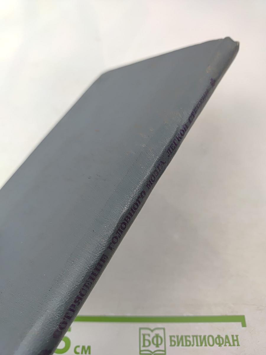 Сотрясение головного мозга легкой степени