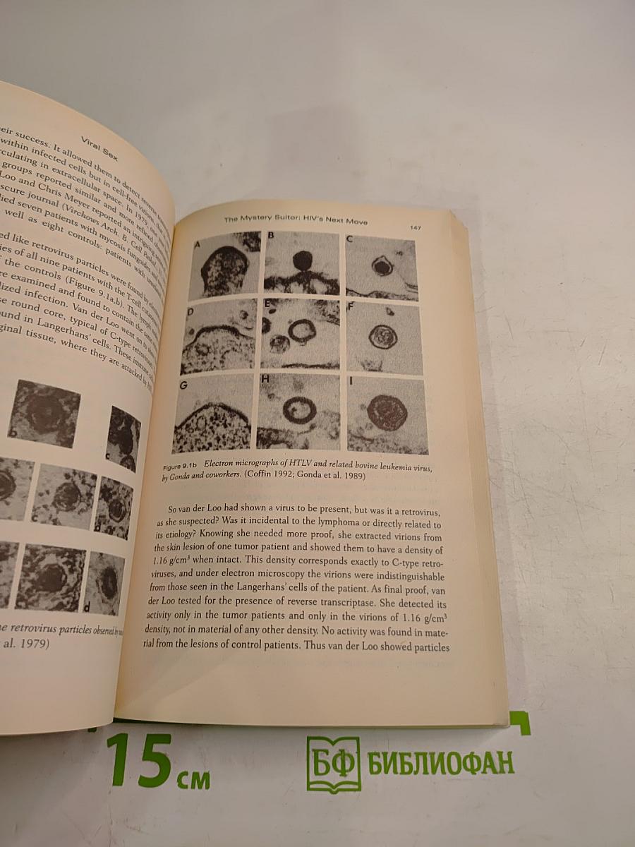 Viral Sex: The Nature of AIDS