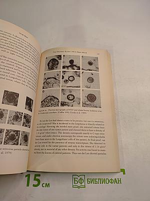 Viral Sex: The Nature of AIDS