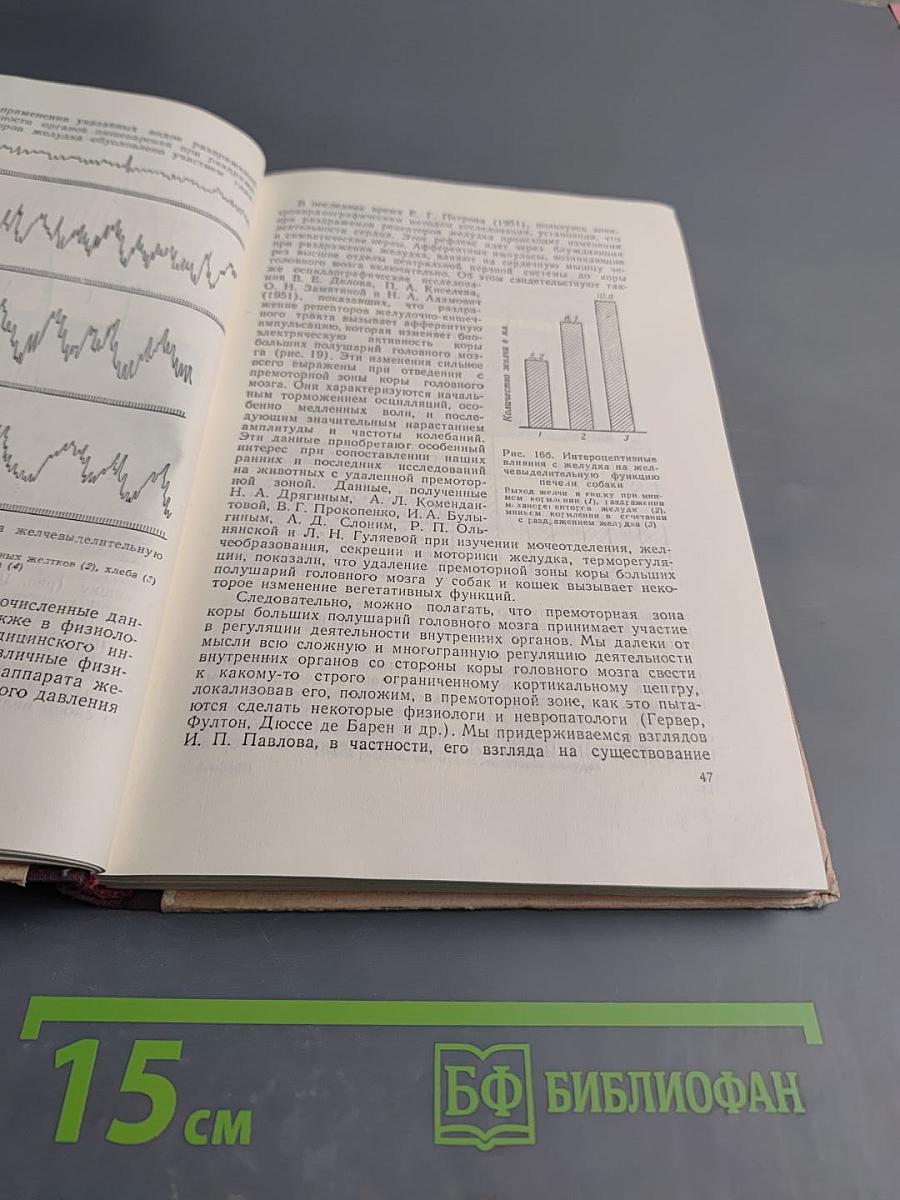 Кортико-висцеральная теория патогенеза язвенной болезни