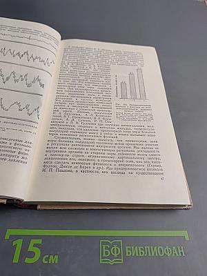 Кортико-висцеральная теория патогенеза язвенной болезни