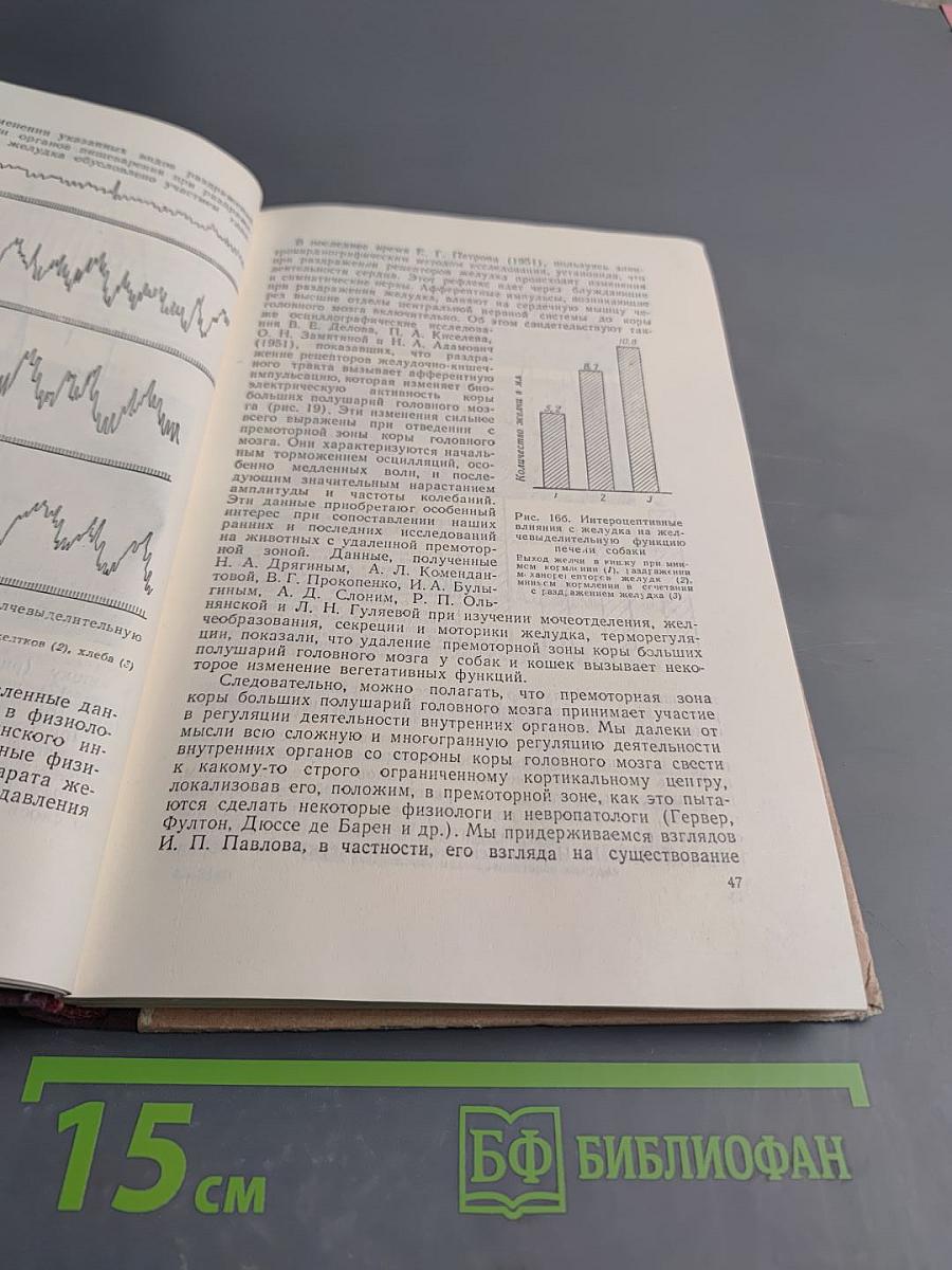 Кортико-висцеральная теория патогенеза язвенной болезни