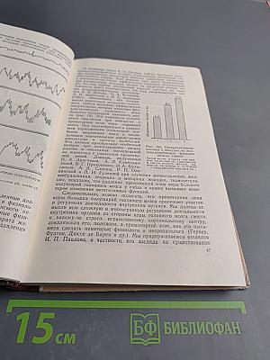 Кортико-висцеральная теория патогенеза язвенной болезни