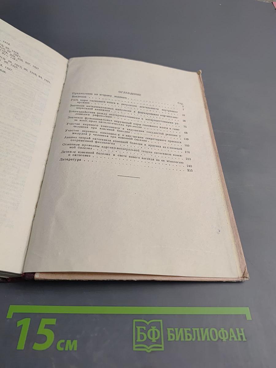 Кортико-висцеральная теория патогенеза язвенной болезни