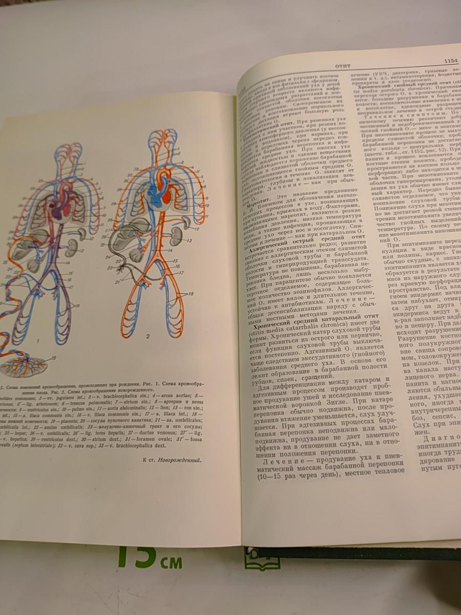Малая медицинская энциклопедия. Том 6. Молокоотсос – Ототопика