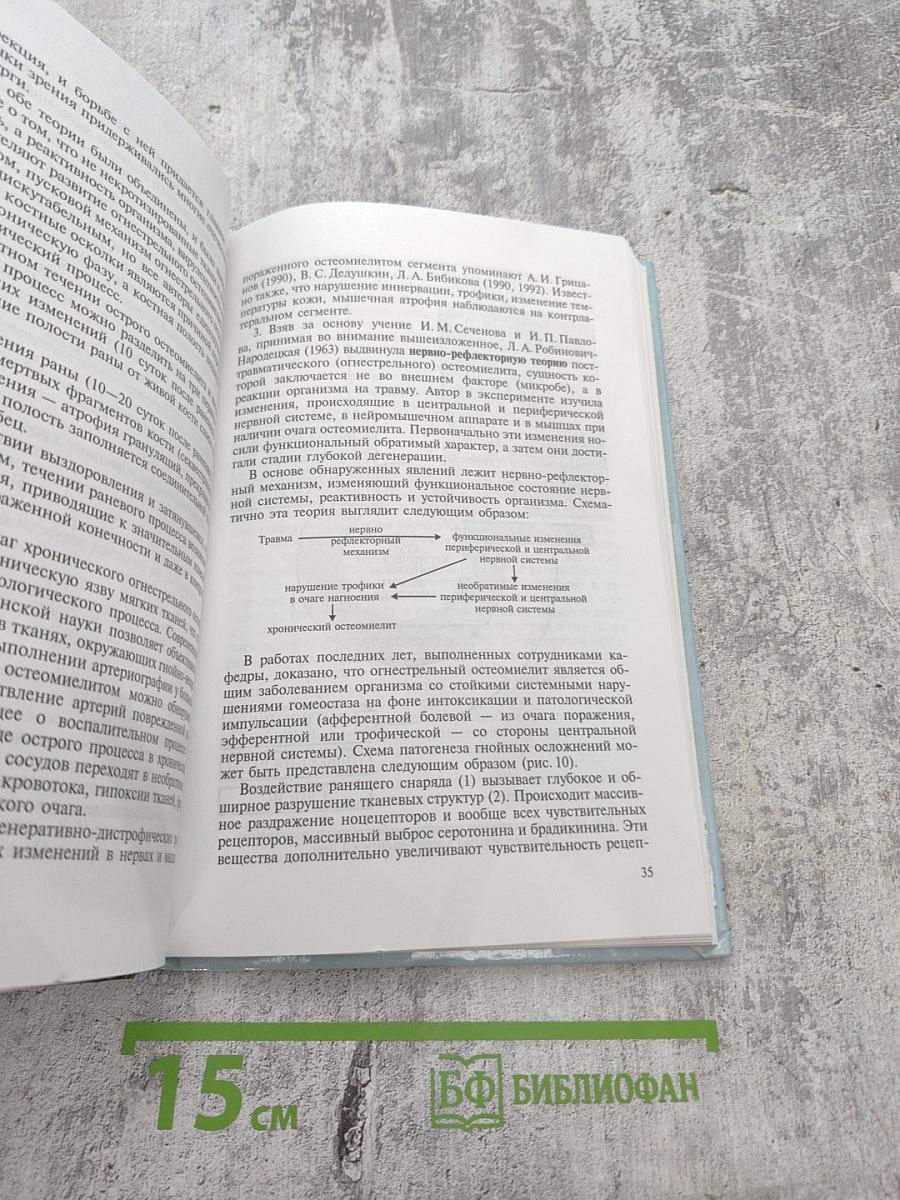 Огнестрельный остеомиелит: Монография