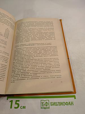 Механизмы желчевыделения