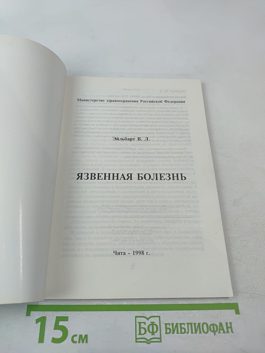 Язвенная болезнь