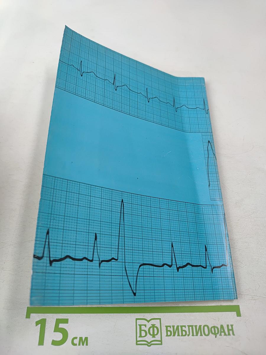 Язвенная болезнь