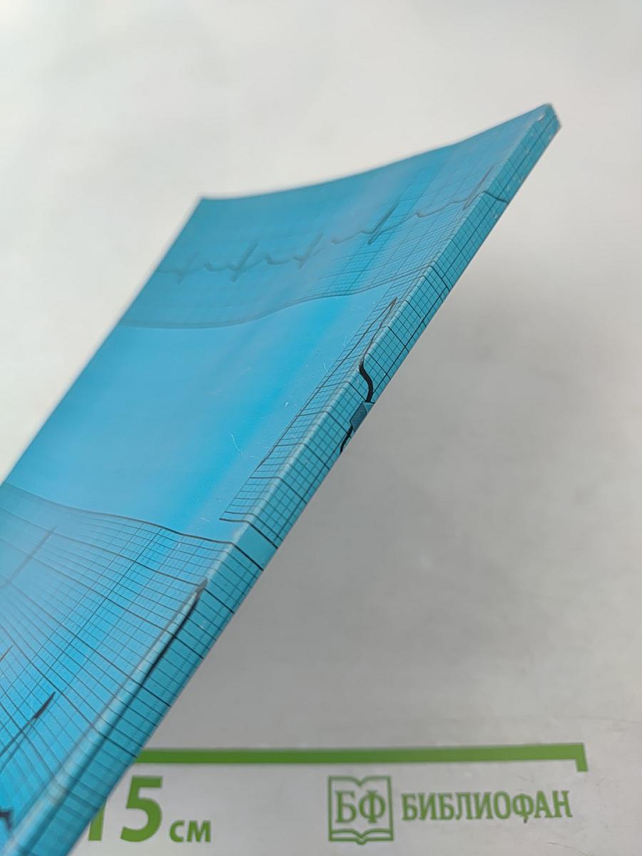 Язвенная болезнь