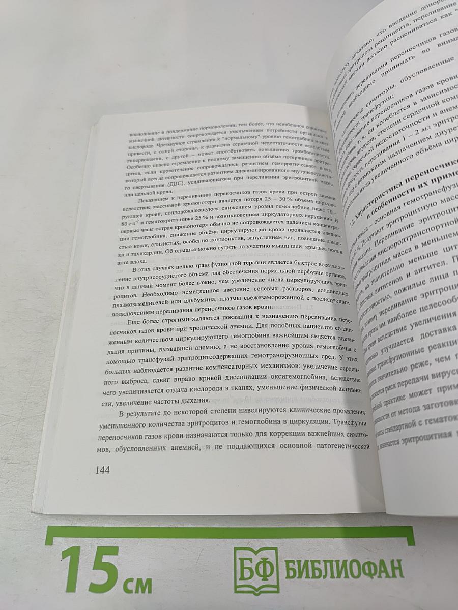 Острая массивная кровопотеря