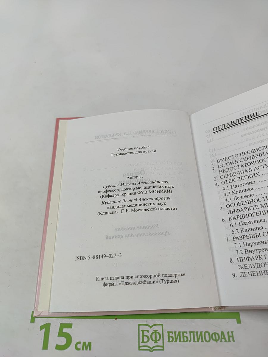 Острая сердечная недостаточность