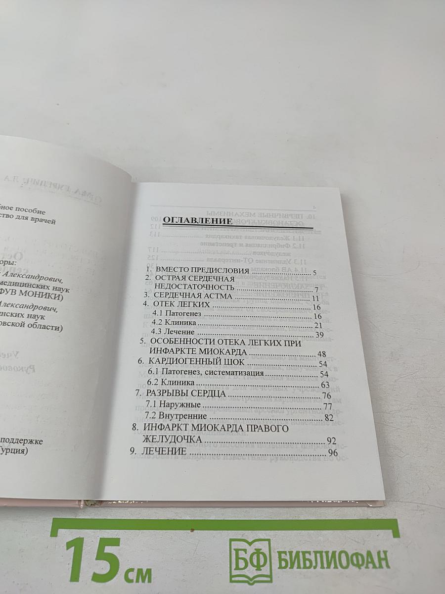 Острая сердечная недостаточность