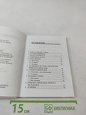 Острая сердечная недостаточность