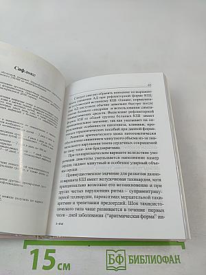 Острая сердечная недостаточность