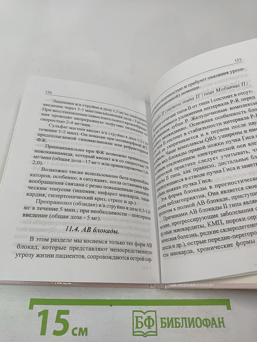 Острая сердечная недостаточность