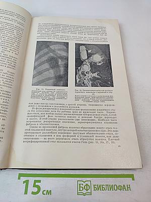 Туберкулез легких. Пособие для студентов и врачей