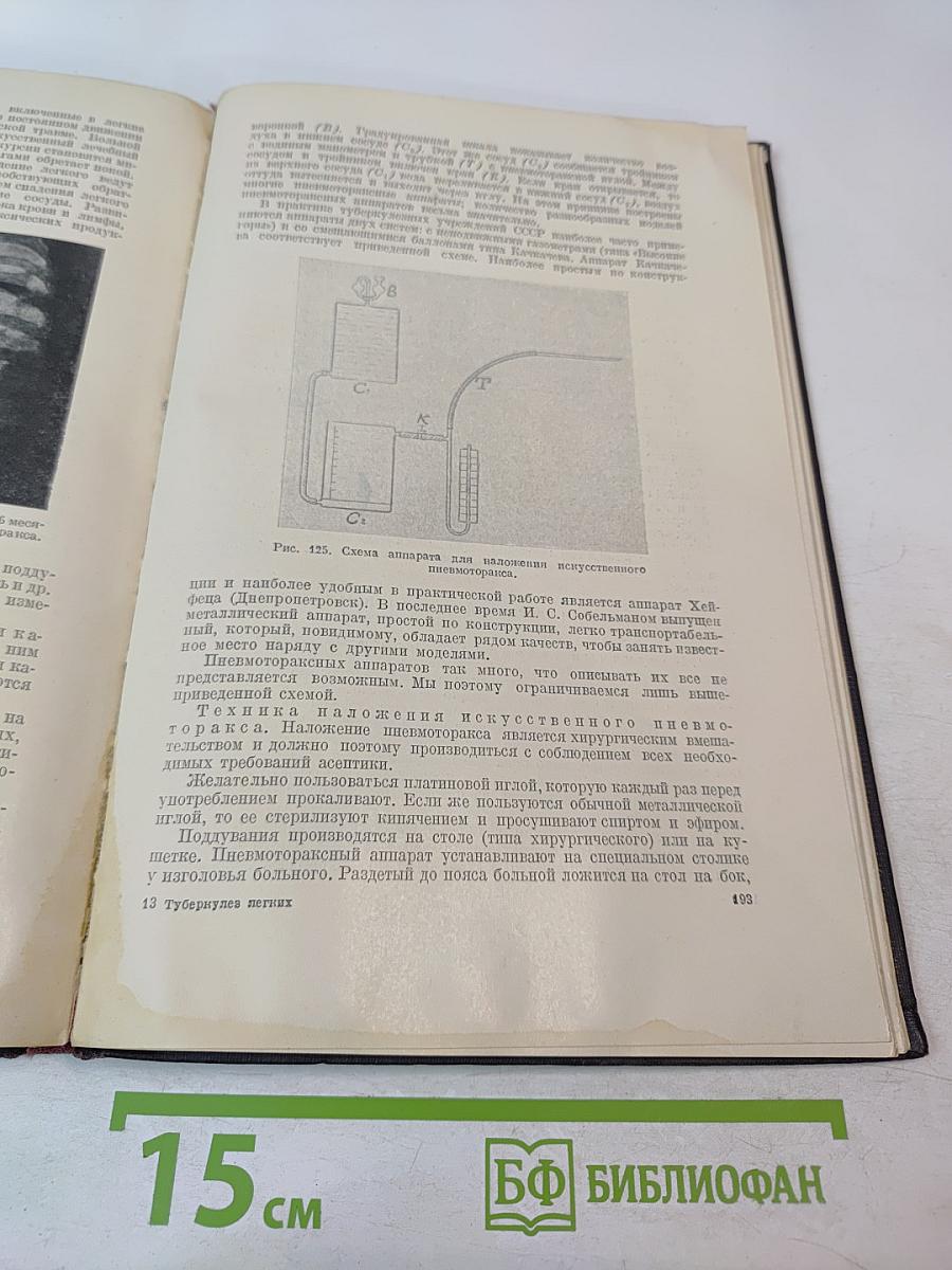 Туберкулез легких. Пособие для студентов и врачей