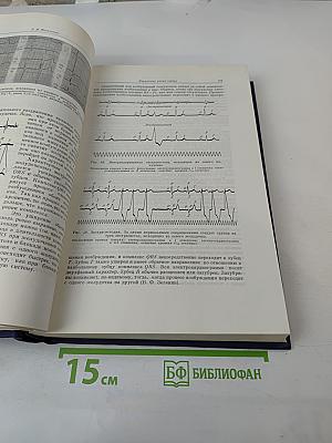 Руководство по внутренним болезням. Том 1: Болезни сердечно-сосудистой системы