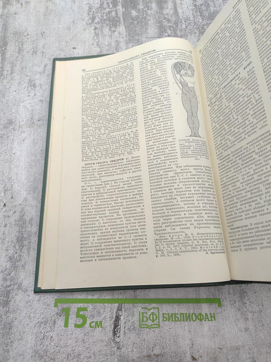 Малая медицинская энциклопедия. Том 2. Бронхоаденит – Гоннотомия