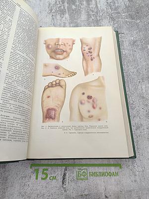 Малая медицинская энциклопедия. Том 9: Репелленты – Спорынья