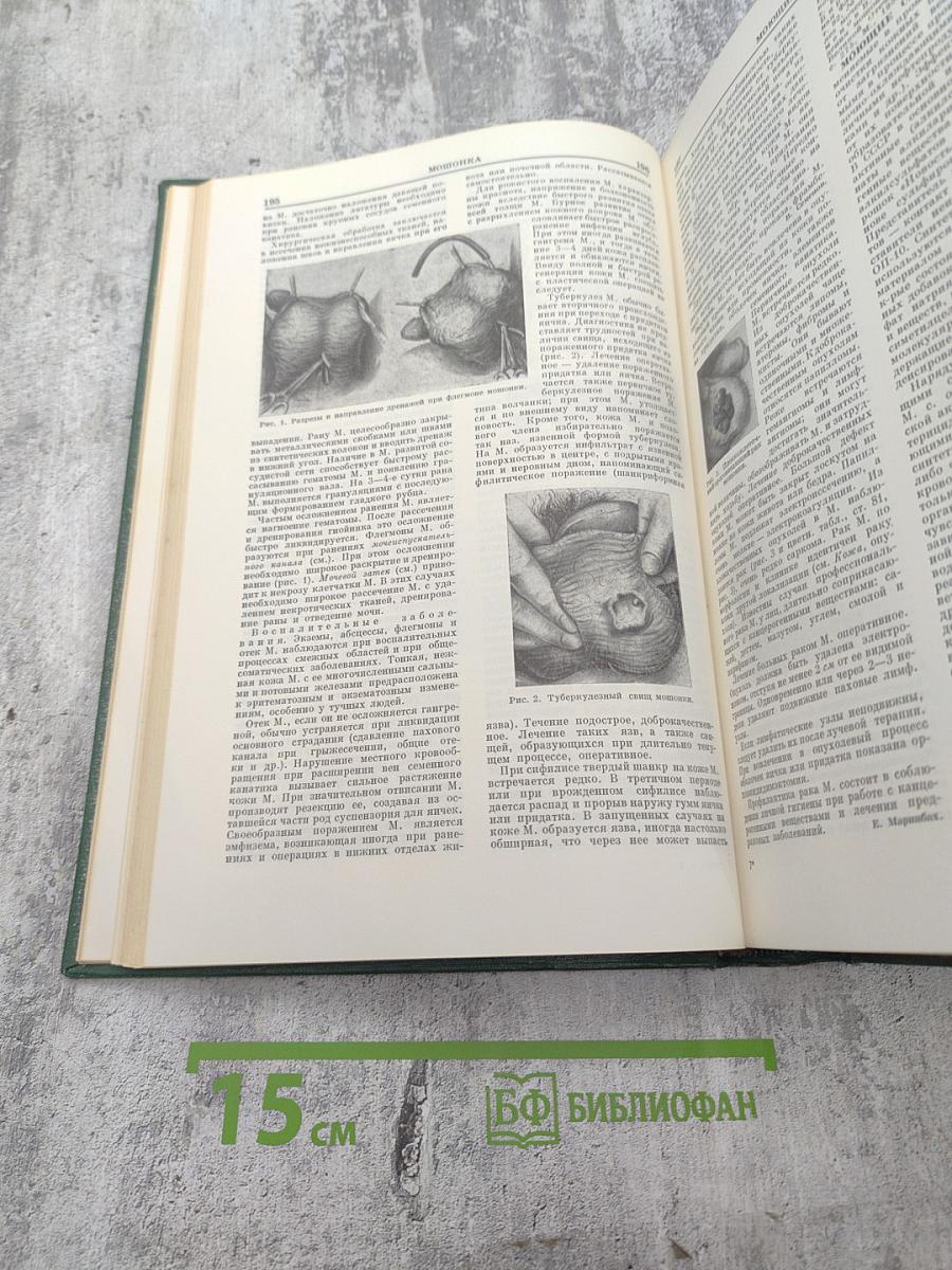 Малая медицинская энциклопедия. Том 6: Молокоотсос - Оттотопика