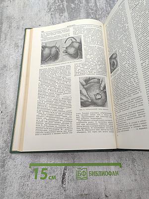 Малая медицинская энциклопедия. Том 6: Молокоотсос - Оттотопика