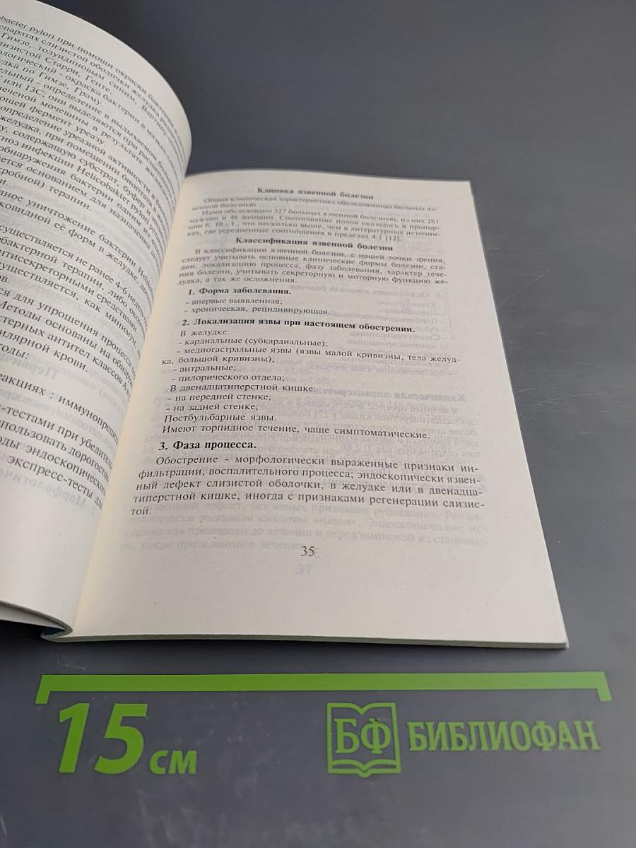 Язвенная болезнь