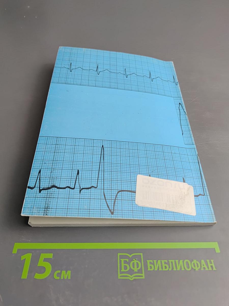 Язвенная болезнь