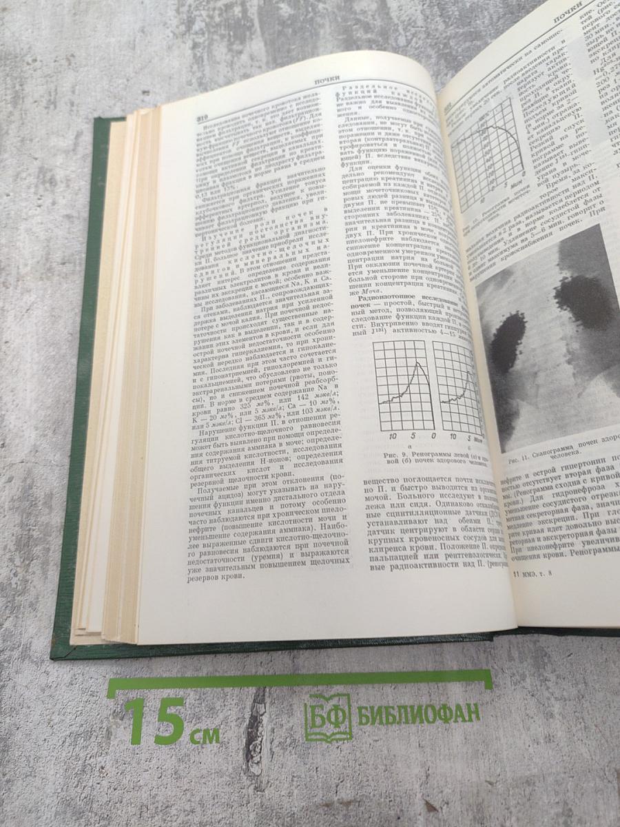 Малая медицинская энциклопедия. Том 8: Полифагия - Реометры