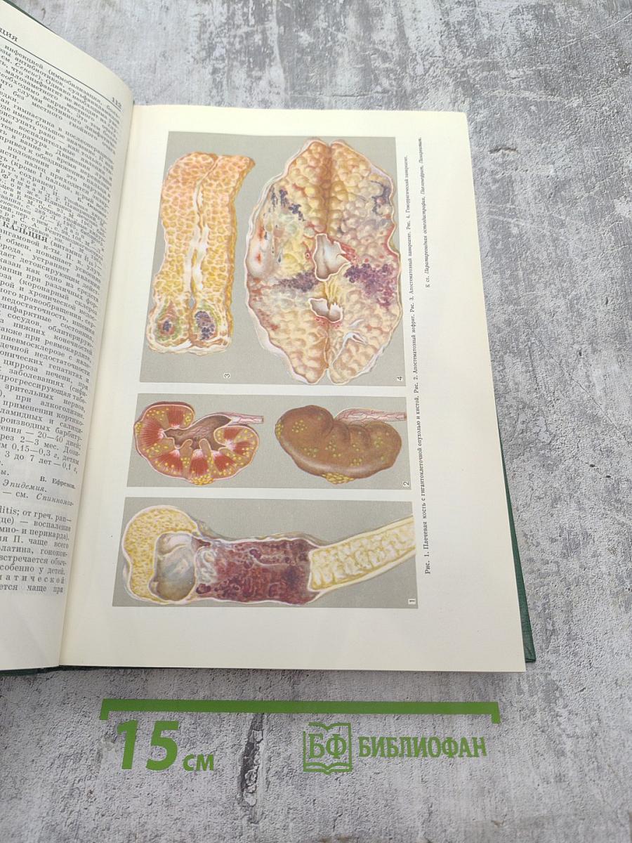 Малая медицинская энциклопедия. Том 7. Отравления - Полиурия