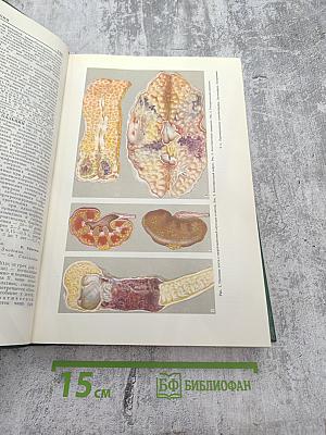 Малая медицинская энциклопедия. Том 7. Отравления - Полиурия